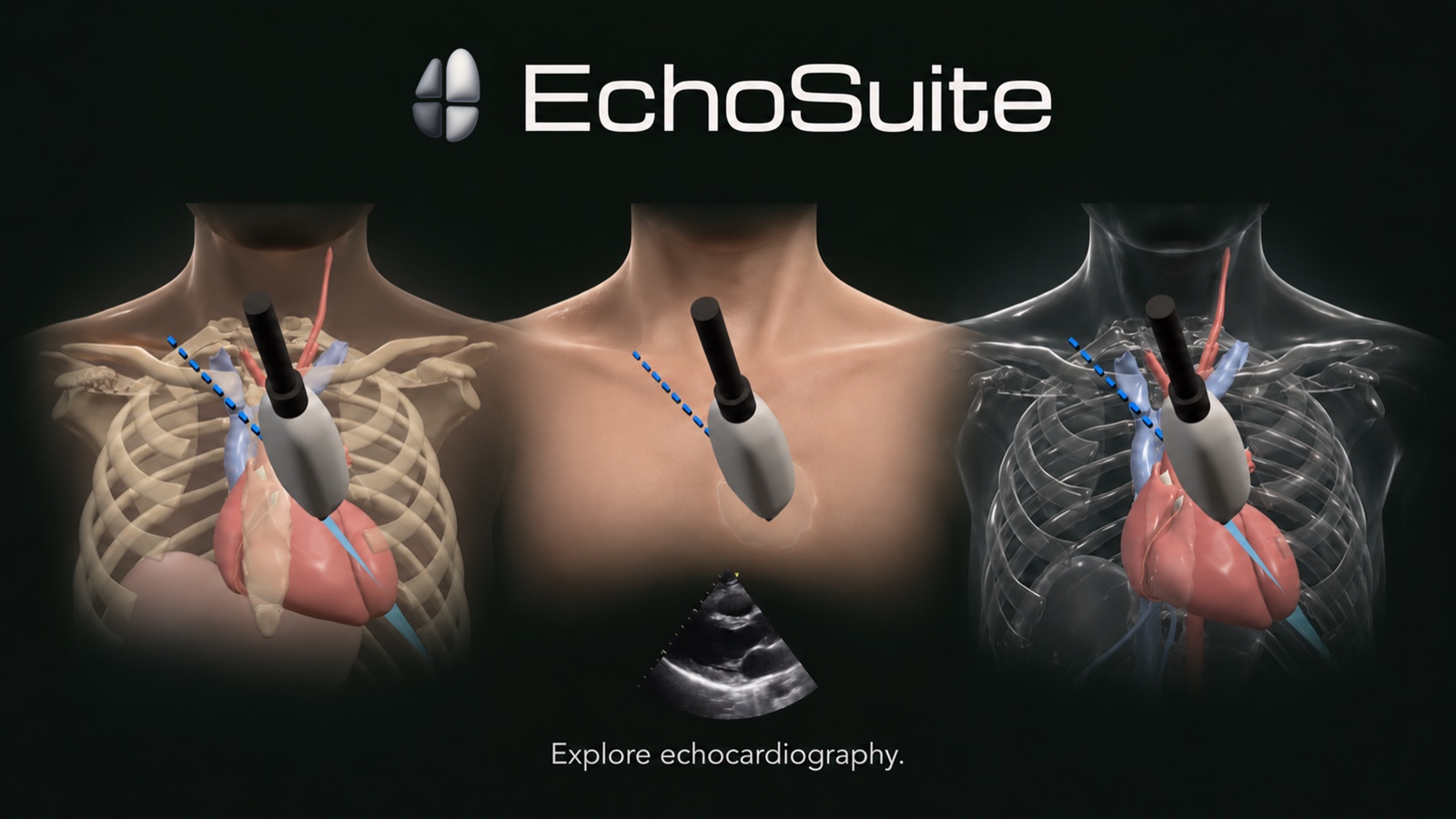 EchoSuite Probe Lab pairs a 3D probe and mannequin with an echocardiographic image, showing skin, glass and anatomy views.